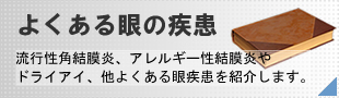 よくある眼の疾患。流行性角結膜炎、アレルギー性結膜炎やドライアイ、他よくある眼疾患を紹介します。